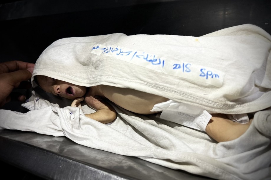 Gaza death toll tops 62,600 as 8 more Palestinians die of starvation – Middle East Monitor