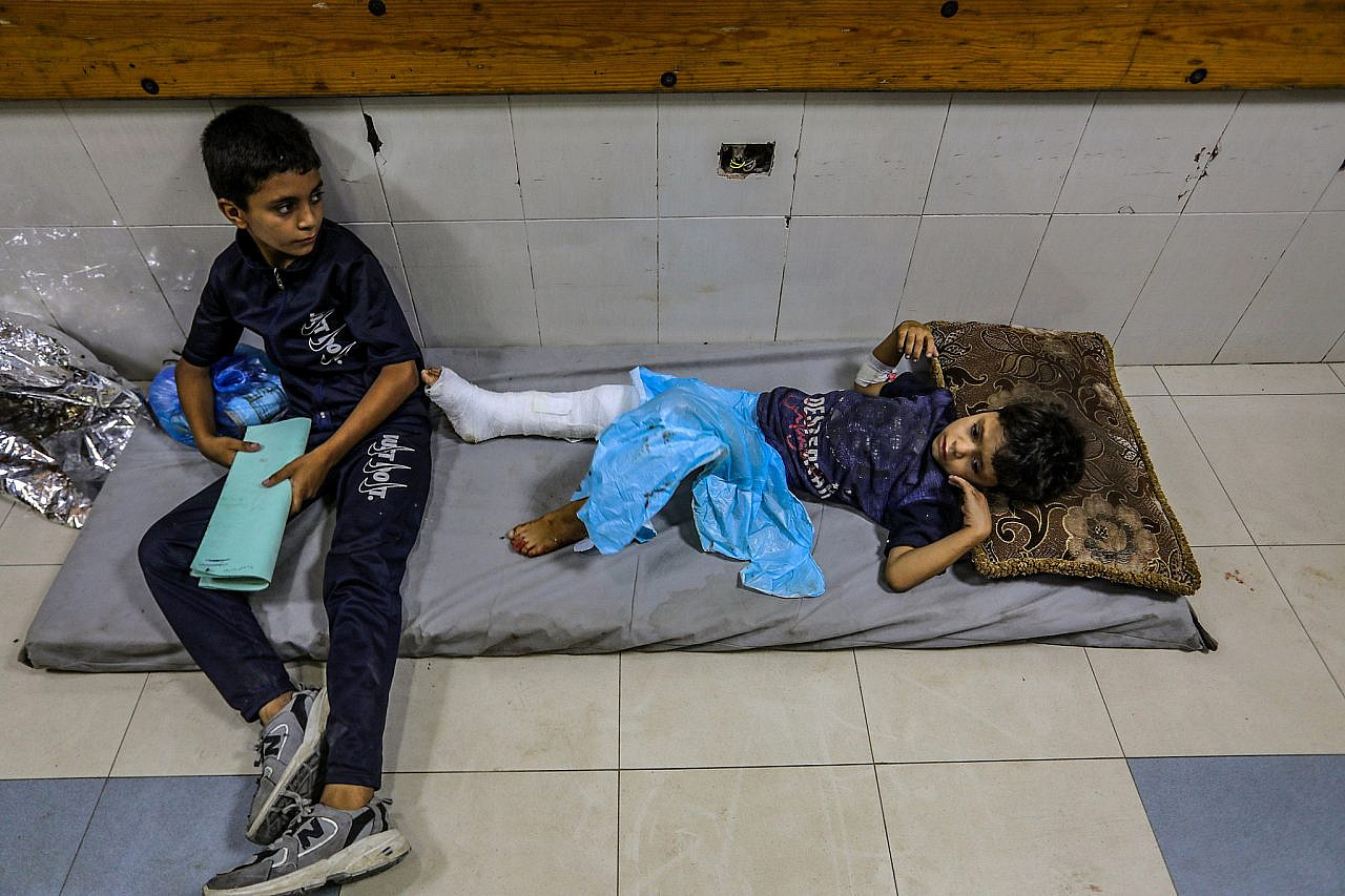 Palestinian children who were wounded in an Israeli airstrike arrive at the Nasser Hospital in Khan Younis, the southern Gaza Strip, June 19, 2025. (Abed Rahim Khatib/Flash90)