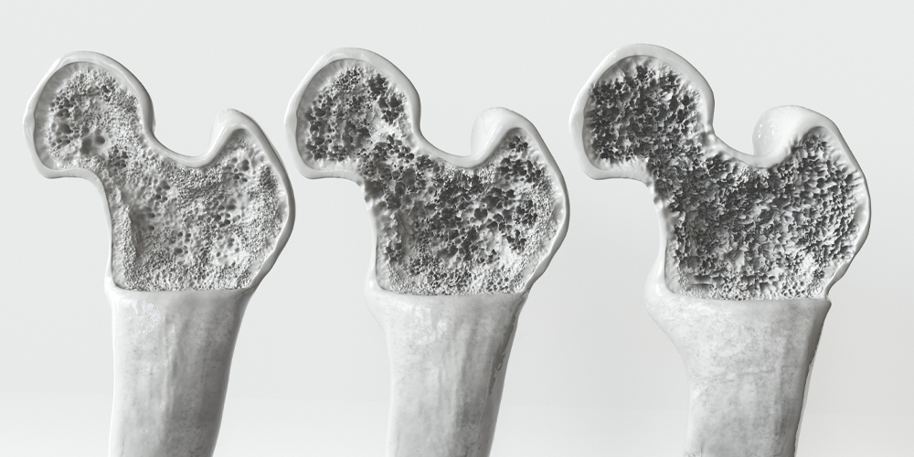 Receptor antagonist reduces age-related bone loss in mice