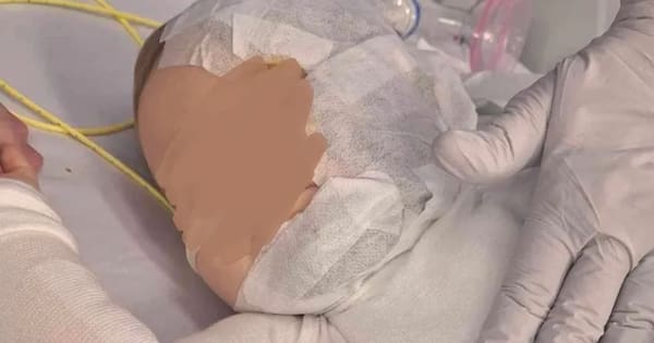 Brisbane mum calls for justice one year after baby scalded with hot coffee