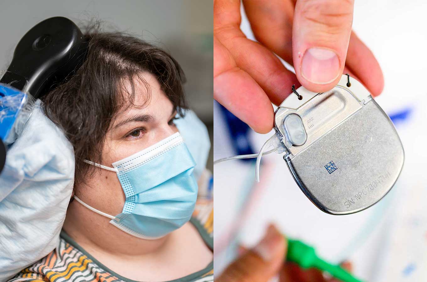 From Chronic Pain to Parkinson’s, 4 Ways DBS is Changing Care