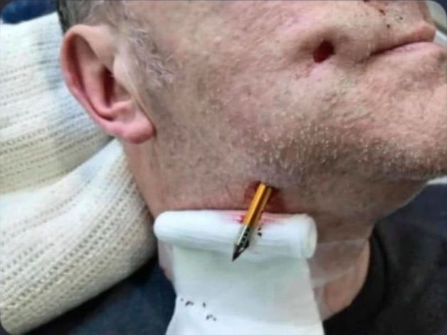 Darren Moore: Picture shows how close ex-UVF thug came to death in crossbow attack