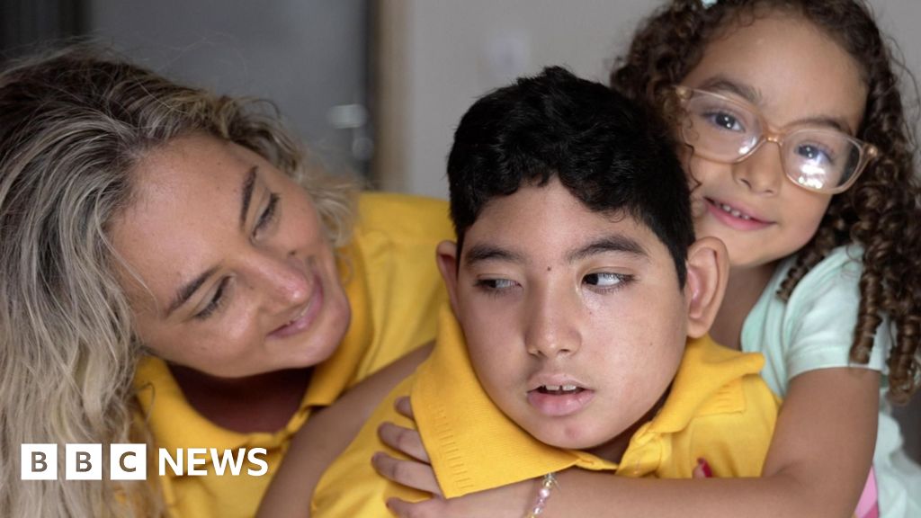 What happened to the babies born with microcephaly?