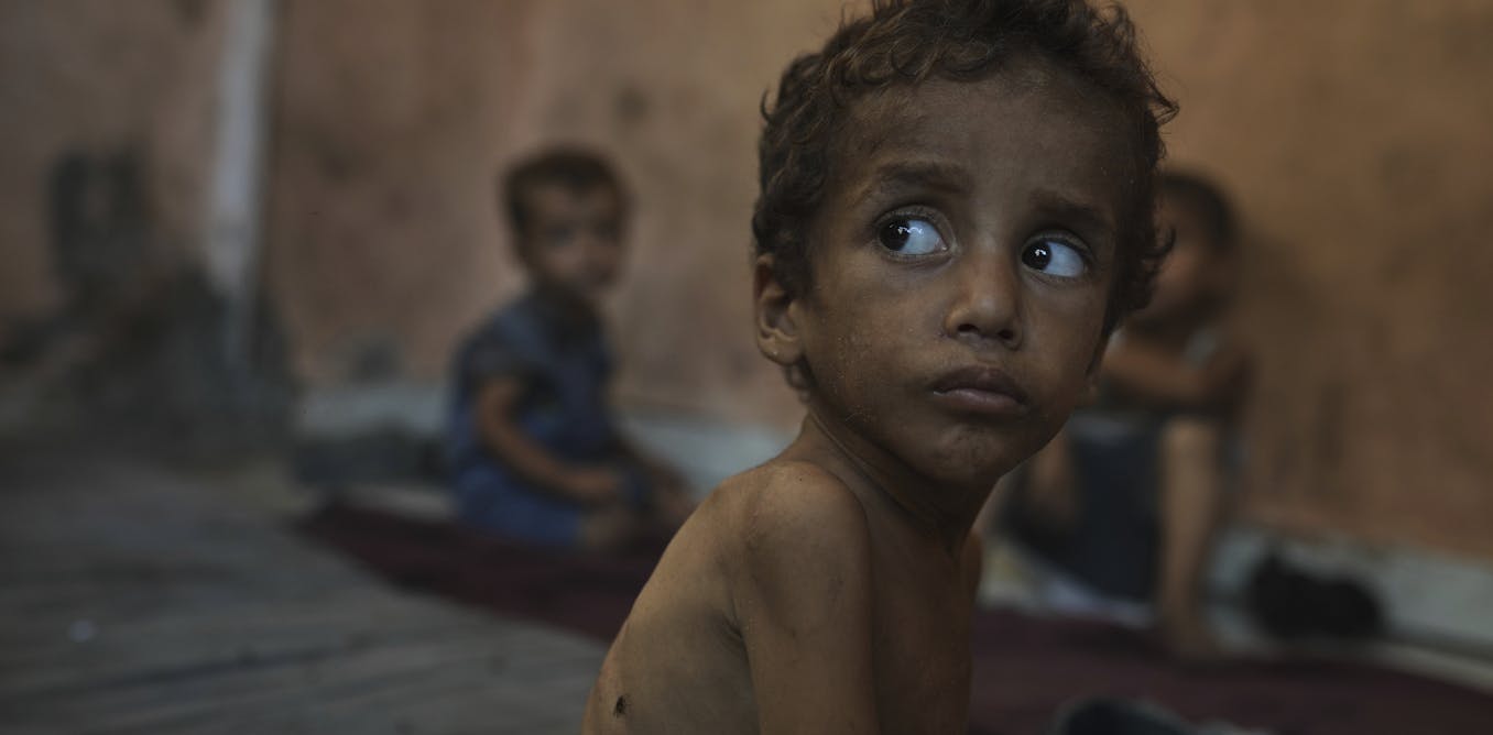 The dark history of forced starvation as a weapon of war against Indigenous peoples