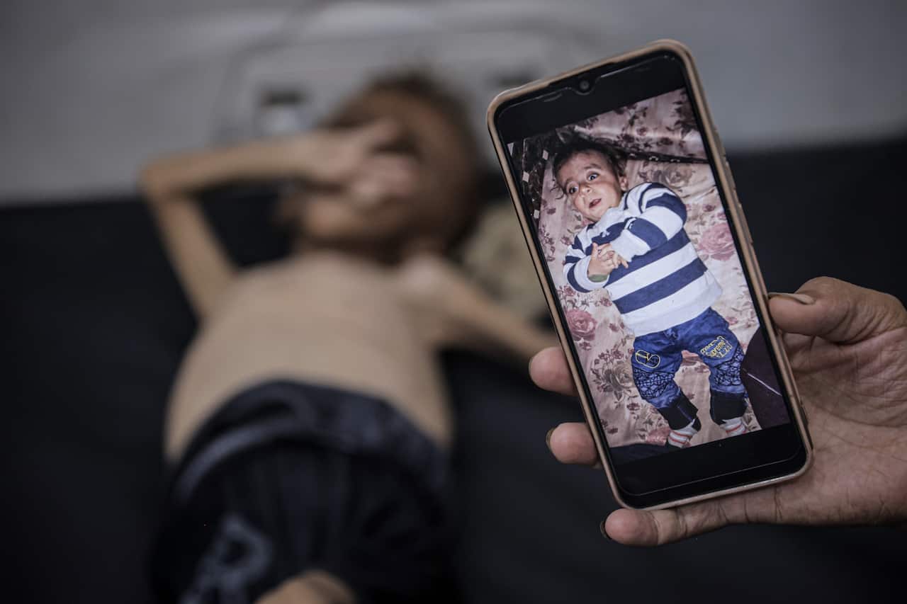 A picture of a baby on a phone in front of a frail child.