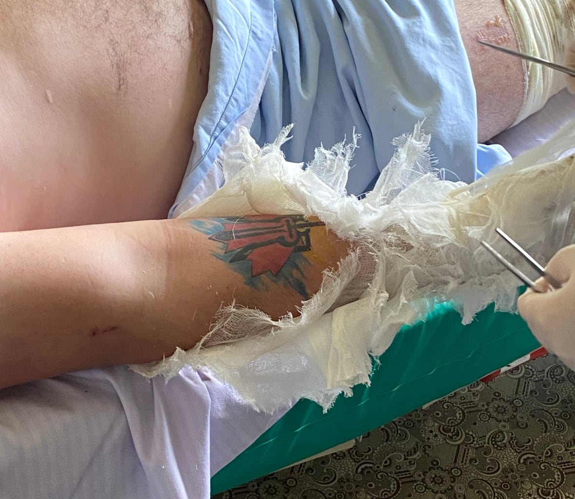 A photo of the tattoo on Mac Hughes' right arm taken at a hospital in Zaporizhzhia on July 2, after he survived a drone attack a day earlier 