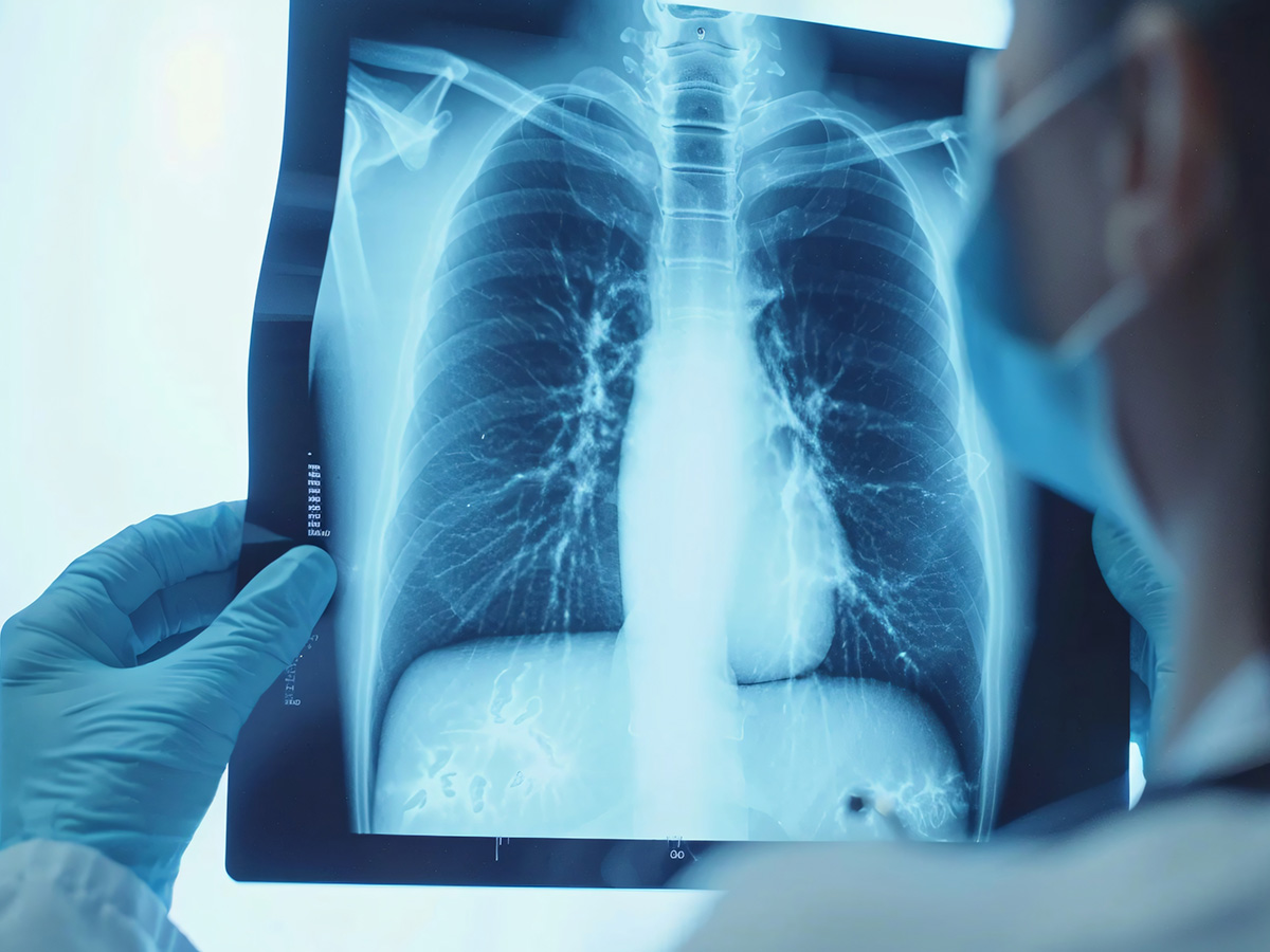 multidimensional diagnosis for COPD 01