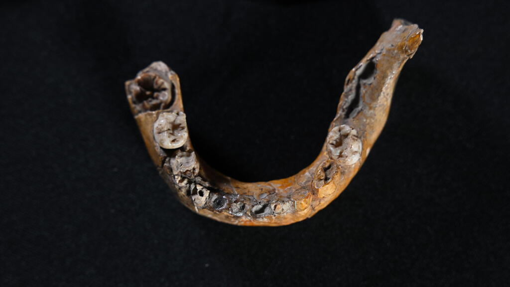 חלק מהגולגולת של הילד