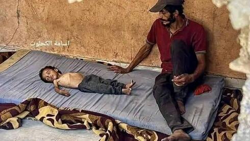 Another Gaza child, treated in Israel for genetic illness, used by Hamas as symbol of