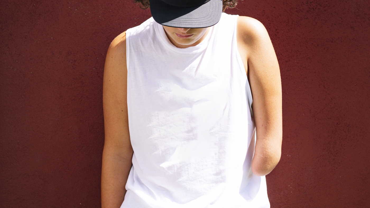 After an amputation, the brain remembers the body's lost limb : Shots