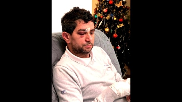 A man injured after an assault