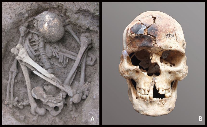 Dating to around 7,000 years ago, the tightly folded skeleton of a young man (left) was found at the Liyupo site in Longan County in Guangxi. The skull was partially burned.