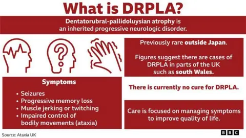A graphic highlighting DRPLA and the symptoms associated with the condition. The headline says What is DRPLA? Underneath it syas Dentatorubral-pallidoluysian atrophy is an inherited progressive neurological disorder. Under that the sub-head reads Symptoms and bullet pointed are four symptoms which read: Seizures, progressive memory loss, muscle jerking or twitching and impaired control of bodily movements (ataxia). To the right of this it says Previously rare outside Japan, and under this reads Figures suggest there are cases of DRPLA in parts of the UK such as south Wales. Under this it says There is currently no cure for DRPLA. And the final line in the graphic reads Care is focused on managing symptoms to improve quality of life. 