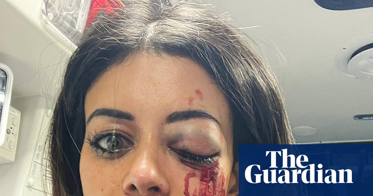 Police officer charged with assault after Hannah Thomas injured at pro-Palestine protest in Sydney | Australian police and policing