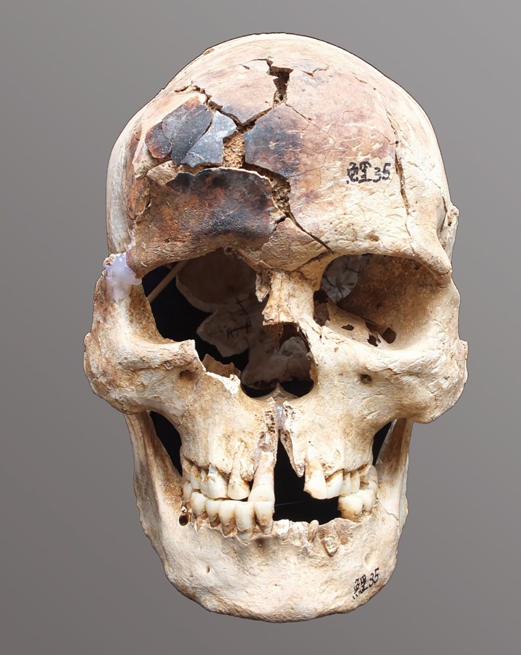 Burials with partially burned skeletal remains were frequently observed at pre-Neolithic sites in southern China and Southeast Asia. 