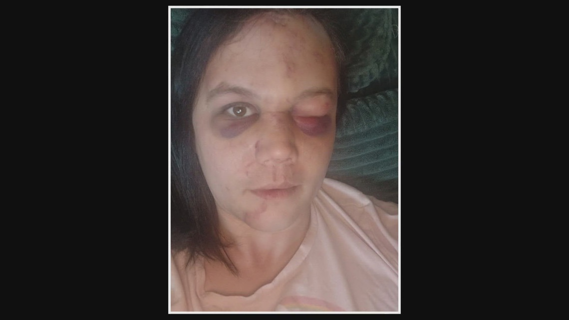 Outstanding suspects in Renton attack on transgender woman arrested