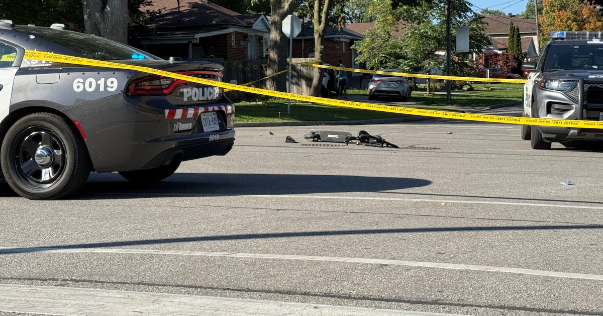 Boy on scooter in hospital after being struck by car