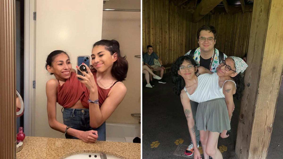 Conjoined twins Carmen and Lupita Andrade: Twins and husband discuss how they manage intimacy and respect