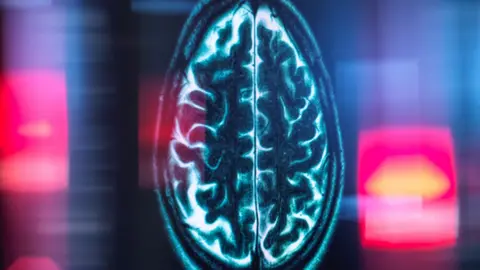 Getty Images The image shows a digital scan of a human brain - seen from above. You can make our the outlines and folks of the cortex.  