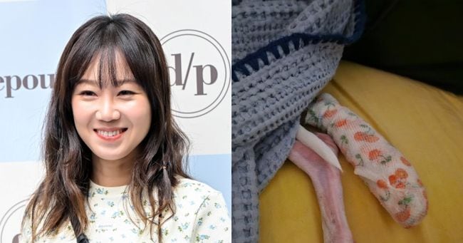 Gong Hyo-jin's Dog Suffers Claw Injury at Airport - 조선일보