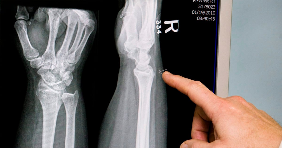 Microplastics detected in human bone marrow; study examines health impacts - CTV News