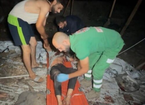 Gaza: Israel Kills At Least 28 Palestinians, Injures Dozens |