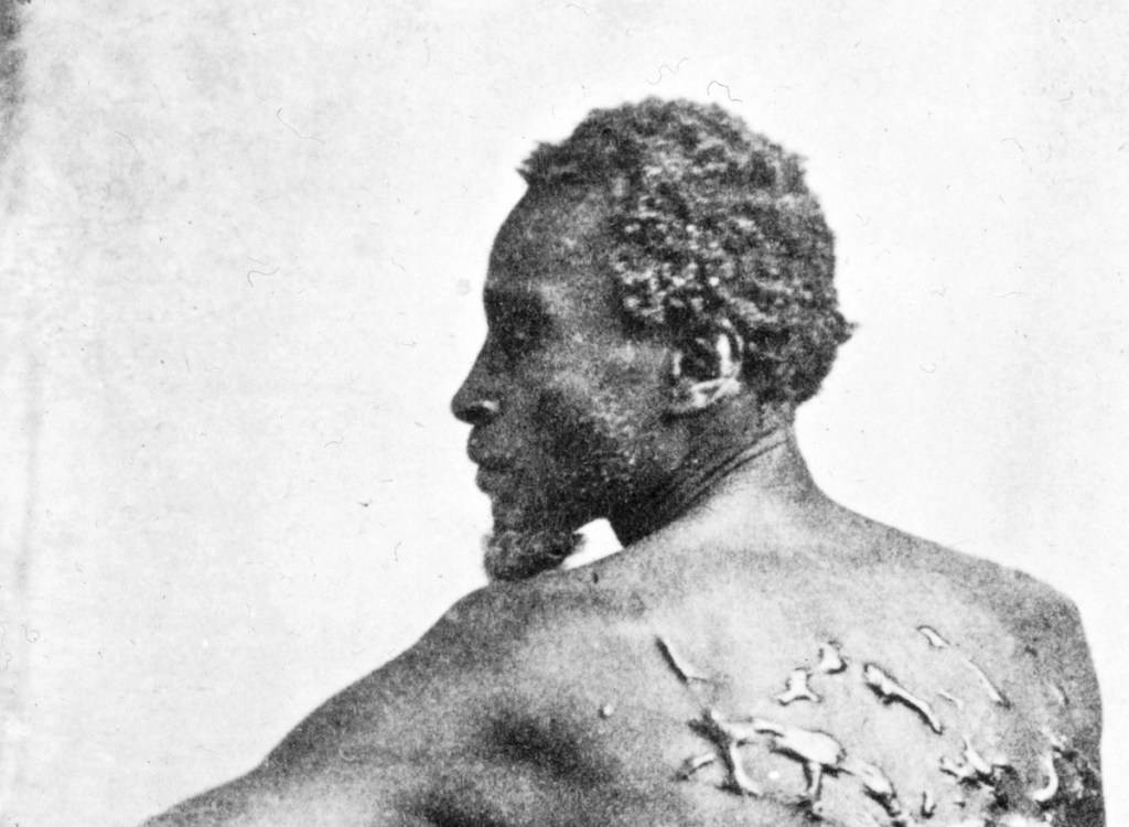 Trump Orders National Park to Remove 'Scourged Back' Photograph