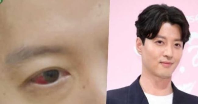 Lee Dong-gun Reveals Rare Ankylosing Spondylitis Diagnosis on SBS Show - 조선일보