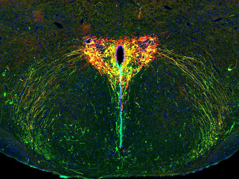 Shining a Light on the Developing Brain: How Parental Separation Shapes Us - Life Sciences | Weizmann Wonder Wander