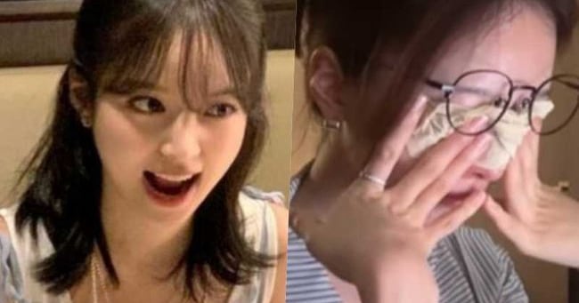 Kim ji-young reveals young-onset glaucoma battle - 조선일보