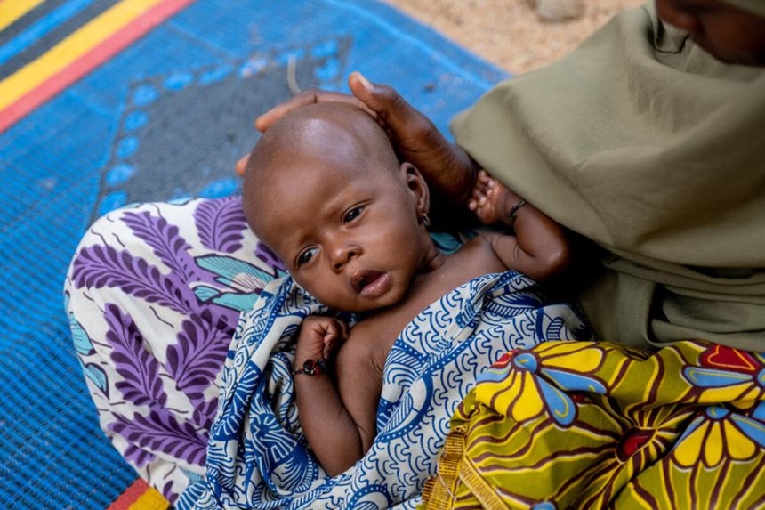 A 6-month-old baby who suffers from severe acute malnutrition is held by its mother at Kachalla Burari Primary Healthcare Center in Damboa, Borno state, Nigeria.