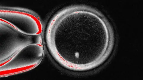 OHSU A largely black and white image showing a round object - it is dark in the middle with a thick band of white at the circumference. There is a bright white dot in the circle at the six o clock position. 