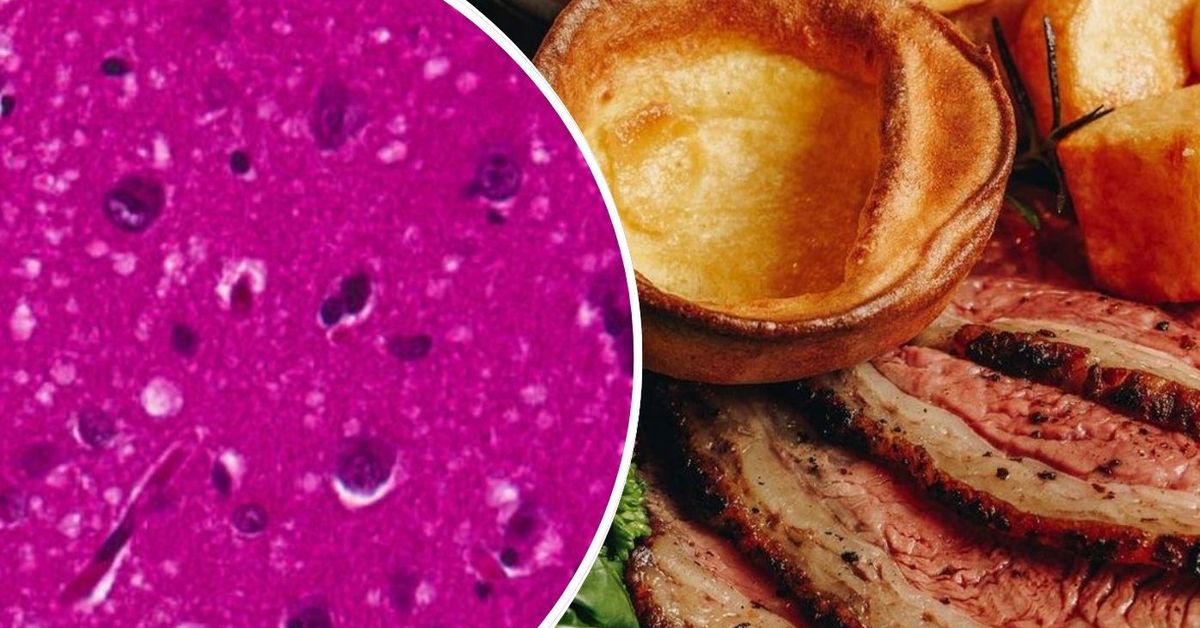 Today in History - September 29: How a beloved national dish turned deadly