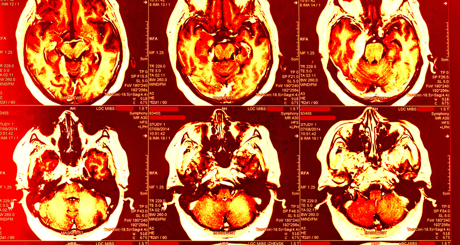 Medical Examiners Found Something Grim About the Brain of the Gunman Who Shot Up the NFL Building