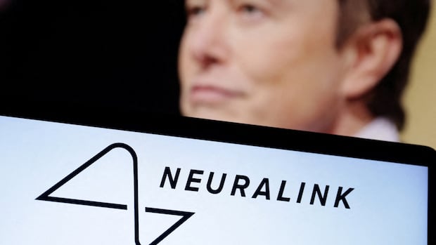 Elon Musk's Neuralink brain chip implanted into 2 quadriplegic Canadian patients as part of clinical trial