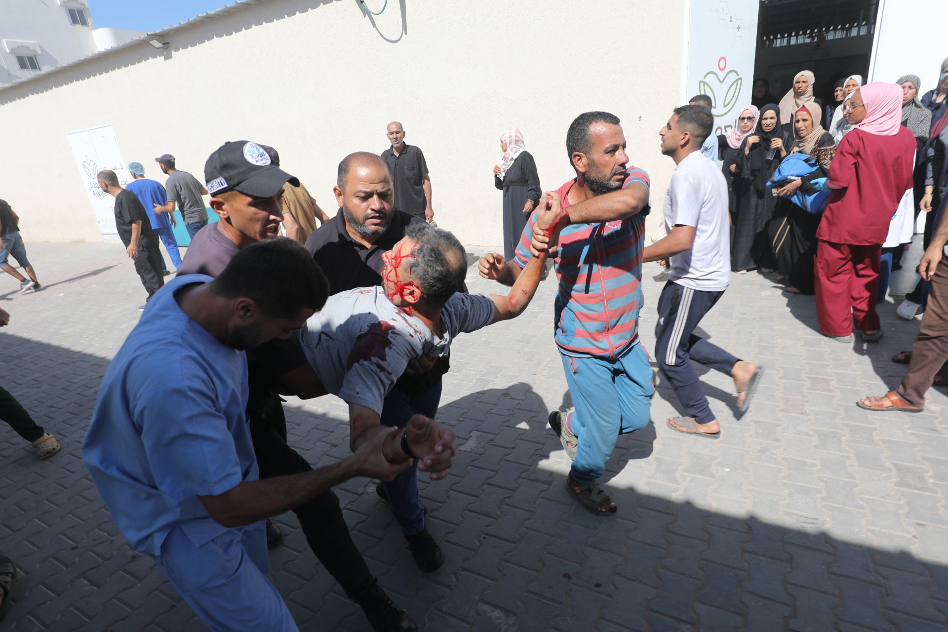 Palestinians carry a wounded person with blood on their face after Israeli forces targeted Al-Awda Hospital in Nuseirat refugee camp.