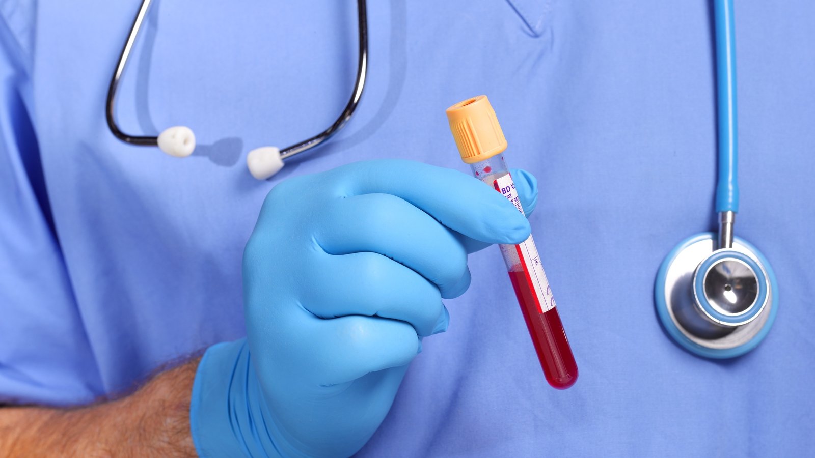 Blood test for 50 cancers delivers 'exciting' results