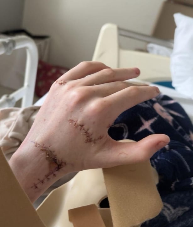 An injury to Niamh Kelly's hand