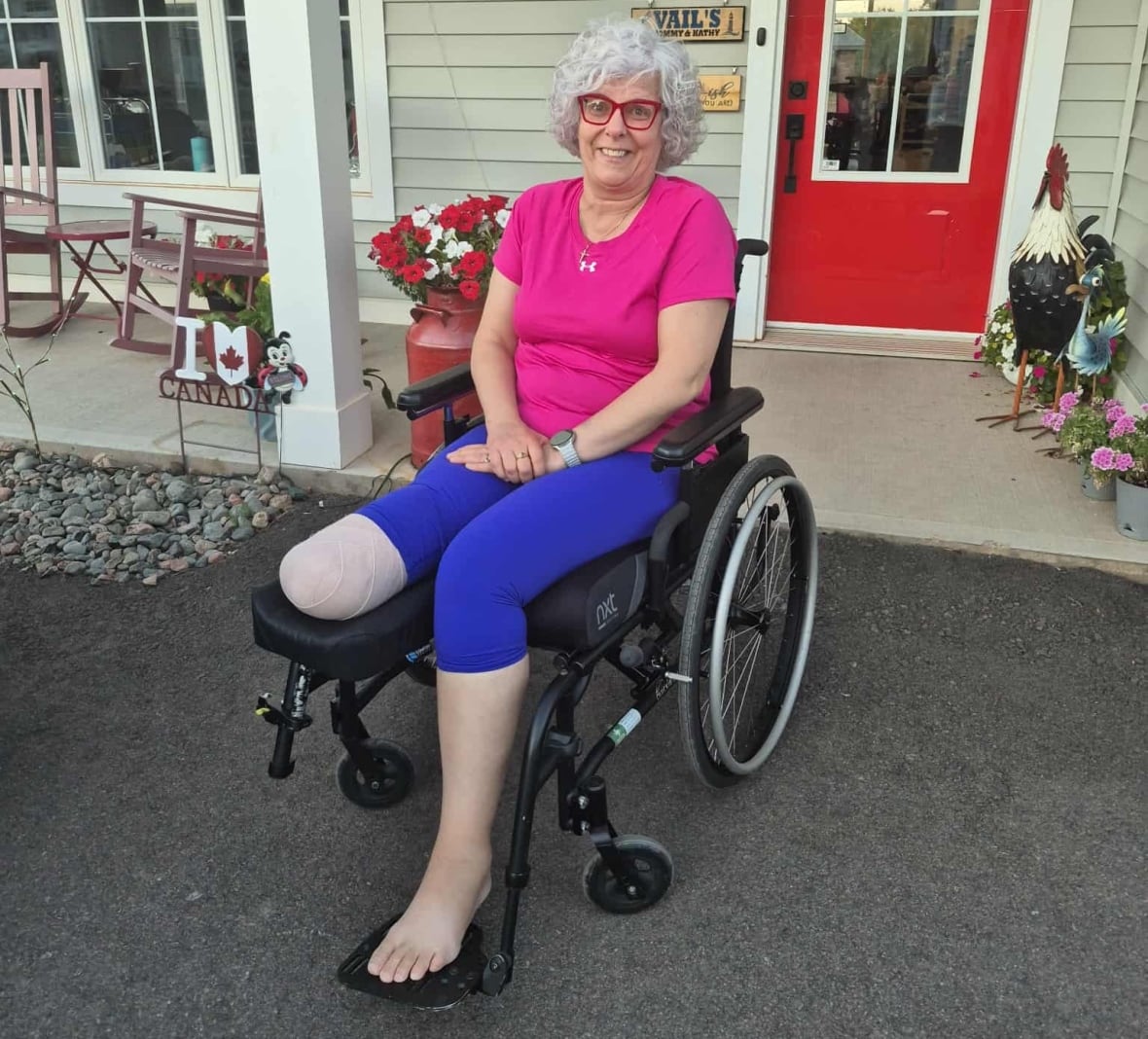 A woman wearing a bright pink T-shirt smiles as she sits in a wheelchair in front of a house. Her right leg has been amputated and the stump is bandaged. 