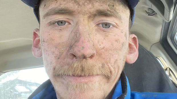 Liam Johnston died on the job at 27. His loved ones want to see change and accountability