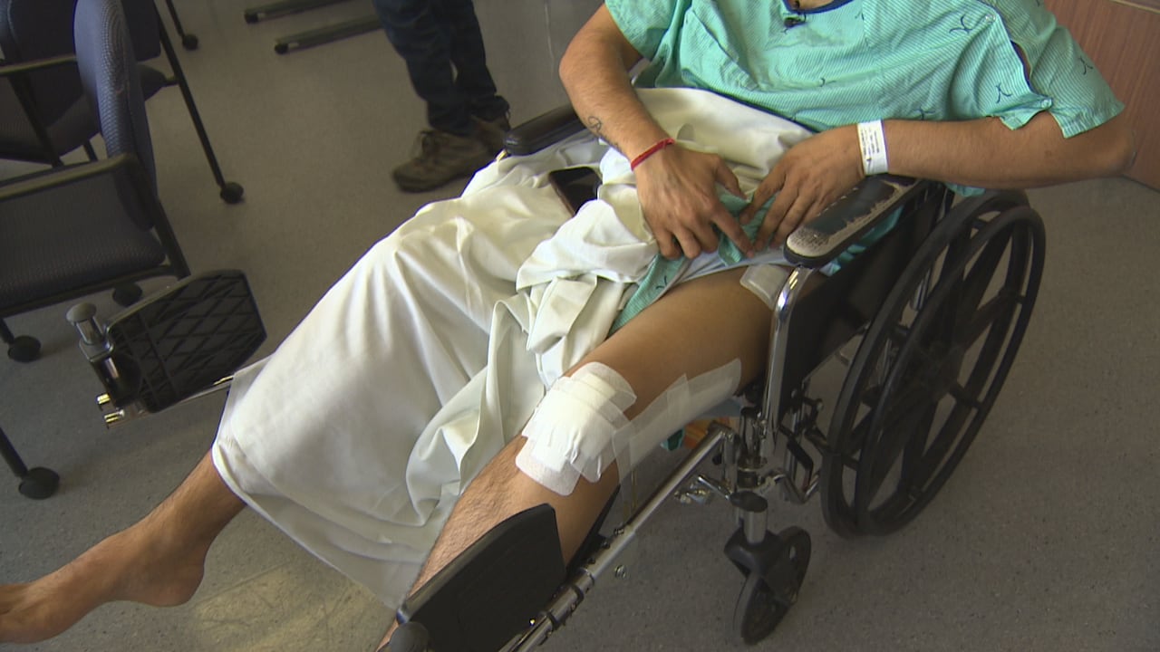 A man shows injuries sustained in an armed robbery