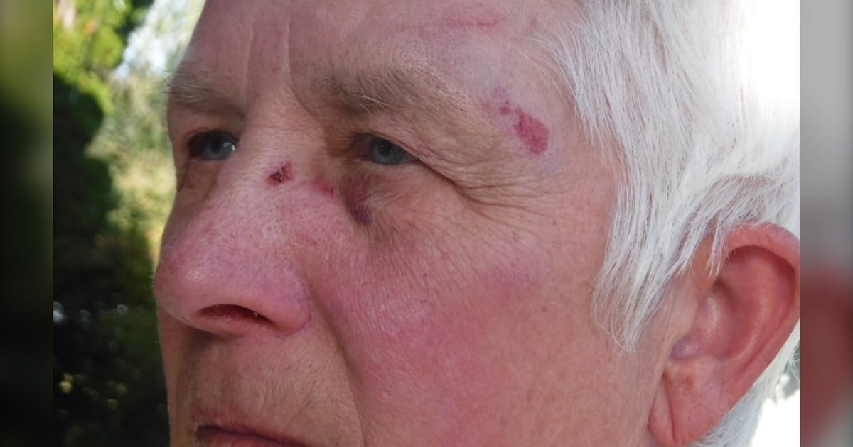 RCMP investigate alleged assault of woman who lives beside B.C. ostrich farm - CTV News