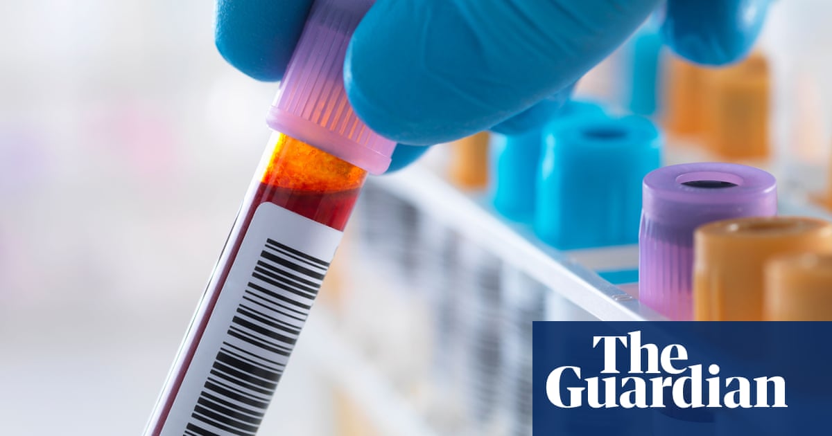 Scientists develop first ‘accurate blood test’ to detect chronic fatigue syndrome | ME / Chronic fatigue syndrome