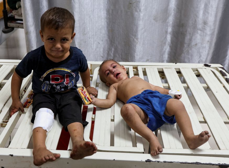 Two Palestinian children were among those being treated in hospital for injuries from an Israeli strike in Khan Younis in the southern Gaza Strip. Photo: Ramadan Abed/Reuters