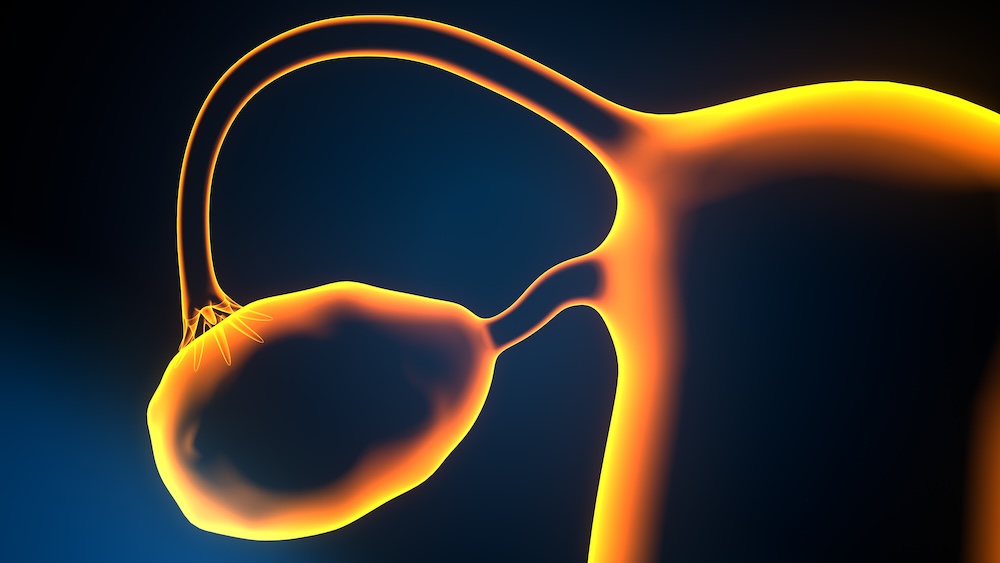 Transcription Factor Drives Chemotherapy Resistance in Ovarian Cancer