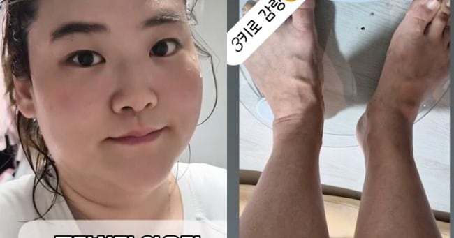 Park Suji Sheds 3kg, Restarts Diet Post-Plateau - 조선일보