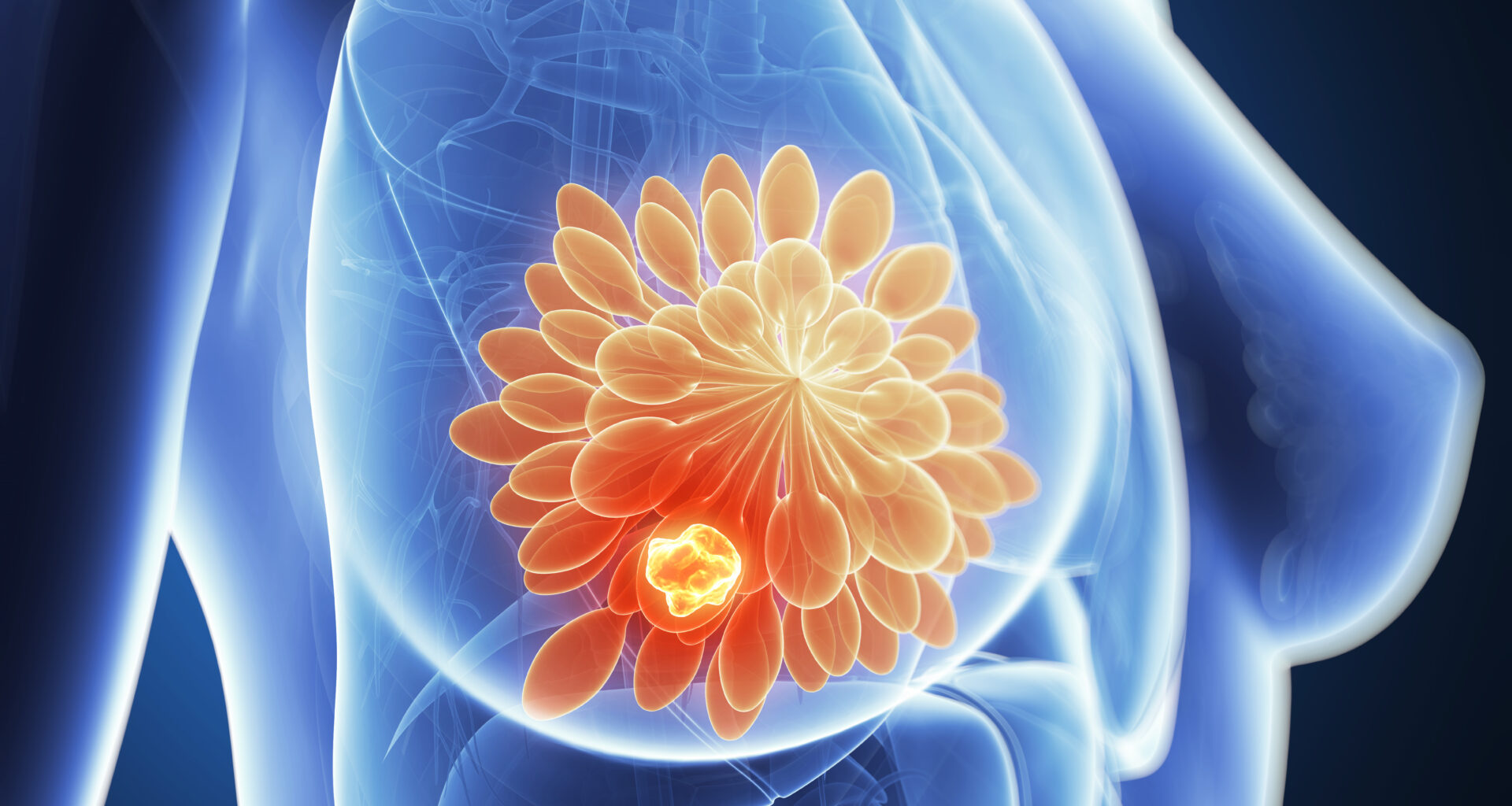 ADC Improves Outcomes for Patients With Advanced TNBC Ineligible for Immunotherapy