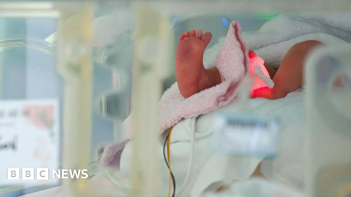 A premature baby in a maternity ward. File photo