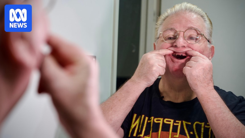 Super withdrawals for dental soar to new heights, prompting calls for more oral health funding