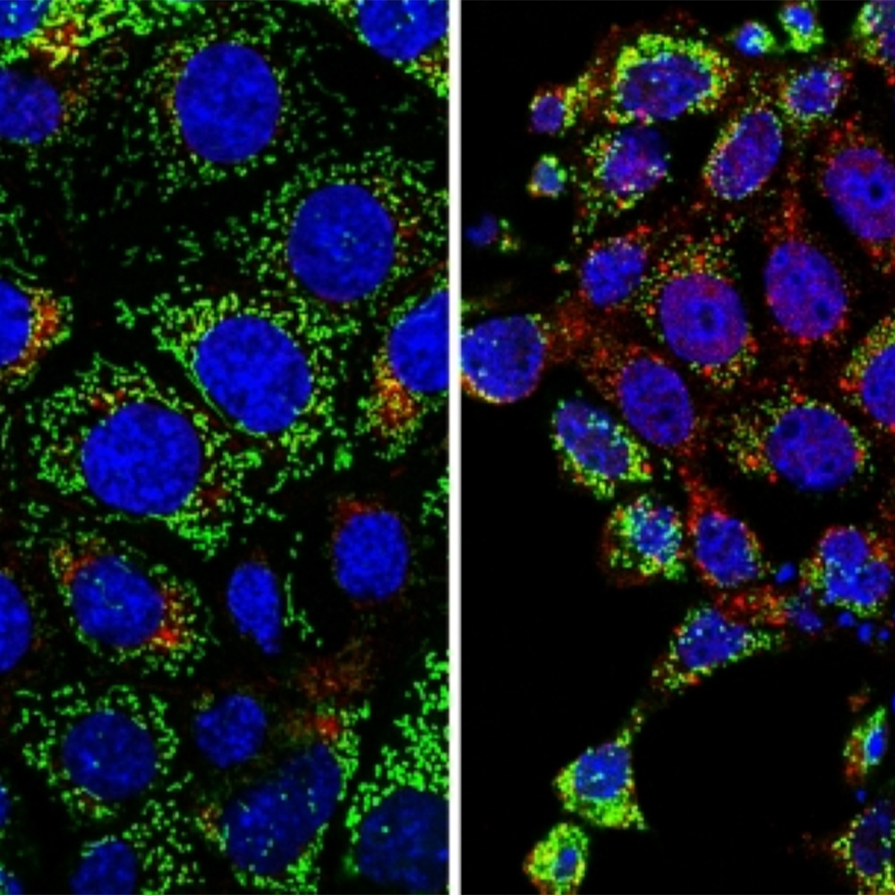 Stressors damage kidneys by mutating mitochondrial DNA : Newsroom